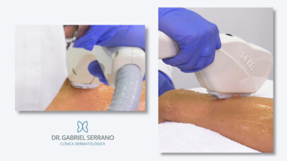 LUZ-PULSADA-INTENSA-PLAY